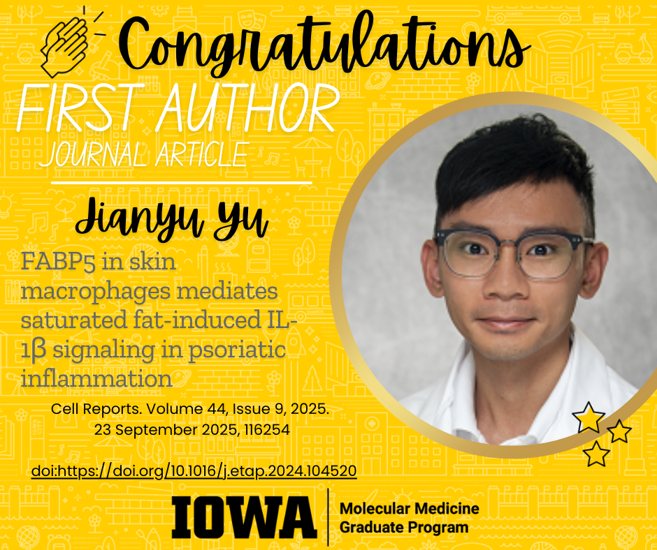 09152025-Jianyu-Yu-First-Author-Journal-Article